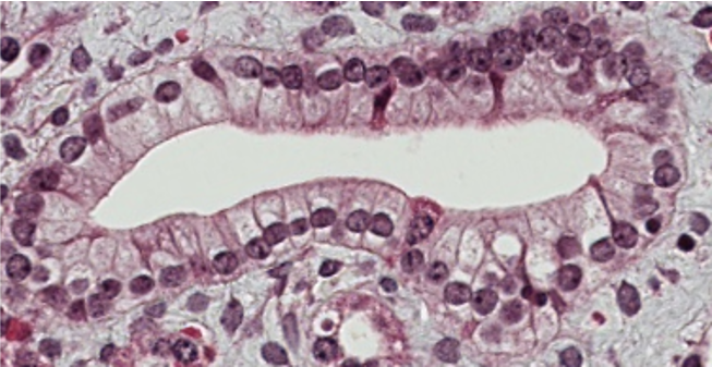 <p><span style="font-family: "Calibri Light";">Which type of epithelium is lining the luminal surface of this structure?</span></p>