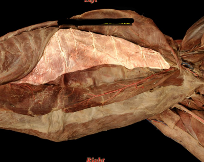 <p>• Lies deep to the internal abdominal oblique m. '</p><p>• Runs across lateral to medial</p>