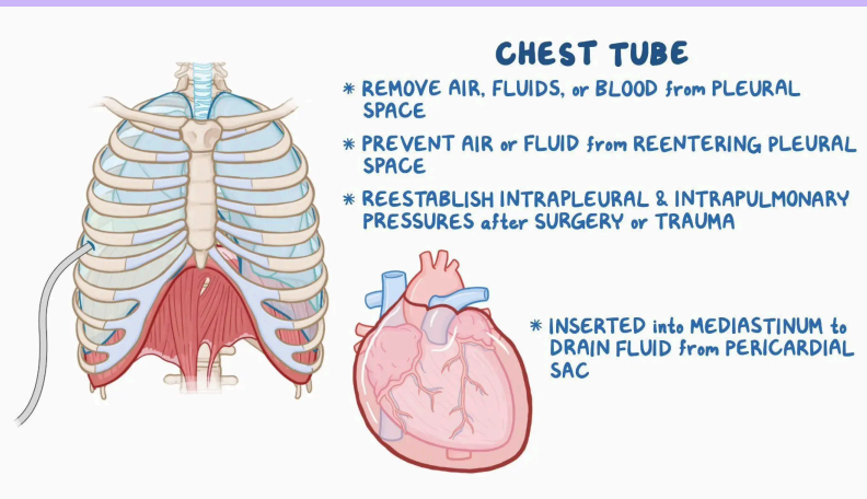 <ul><li><p><span><span>Removes and prevents the reentry of air or fluid from the pleural or mediastinal space and provides negative intrapleural pressure</span></span></p></li><li><p><span><span>Used to treat pneumothorax, hemothorax, pleural effusion</span></span></p></li></ul><p></p>