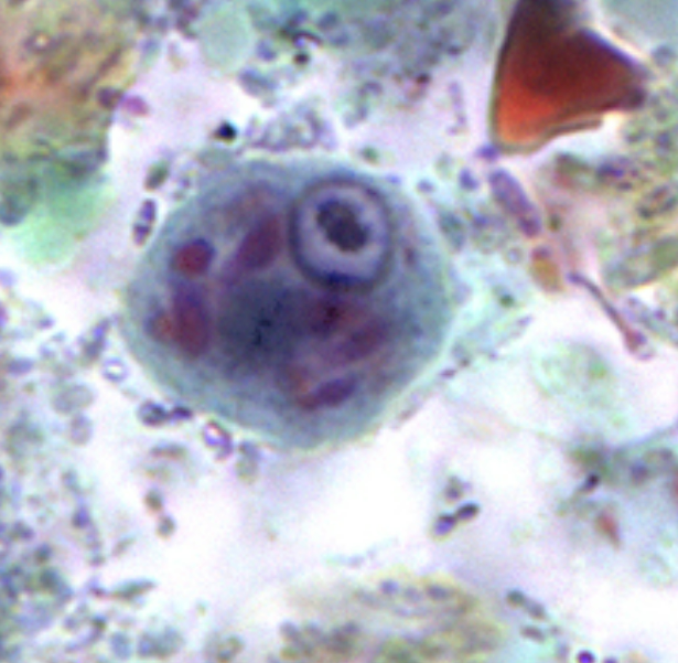 <ol><li><p>Entamoeba polecki</p></li><li><p>Cyst</p></li></ol><p></p>
