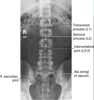 <ul><li><p>Centered at the crest (or 1.5” above) to include T12 to sacrum</p></li><li><p>No rotation</p></li></ul><ul><li><p>Open intervertebral joint spaces</p></li></ul><p></p>