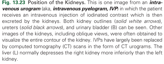 <p>Ureters</p>