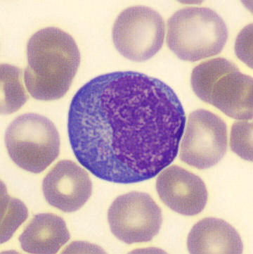 <p>what is a plasmacytoid lymphocyte?</p>