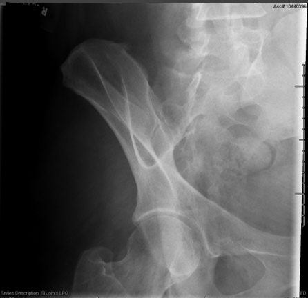 <p>critique for SI obliques </p>