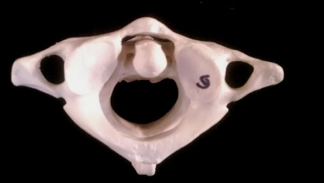 <p>what articulated vertebrae are pictured</p>