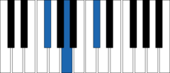 <p>What chord is this?</p>