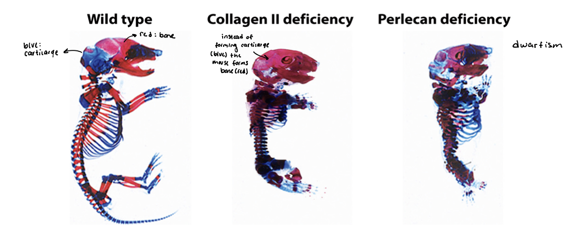 <p>characteristic of various pathologies </p><ul><li><p>skeletons (mouse) → cartilage (blue) and bone (red) </p><ul><li><p>WT → normal </p></li><li><p>collagen II → deficient </p></li><li><p>perlecan → deficient </p></li><li><p>fibronectin → deficient </p></li></ul></li></ul><p>absence of key ECM components leads to <strong><u>dwarfism</u></strong>, with many skeletal elements shortened and disfigured </p>