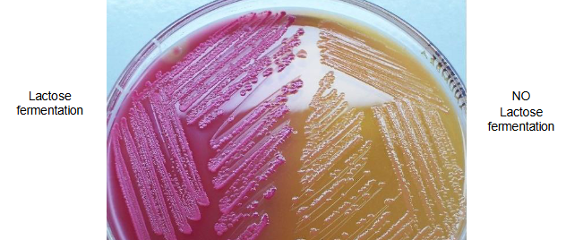 <p>selective and differential media for enteric Bacteria </p><ul><li><p>Contains Crystal Violet and Bile Salts to inhibit the growth of G+ bacteria </p></li><li><p>Contains neutral-red dye to detect Lactose fermentation (indicates coliforms) </p></li></ul><p></p>