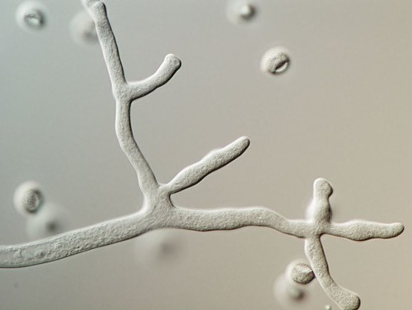 <p>No cross walls within hyphae</p>