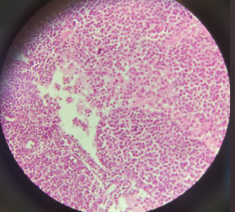 <p>Glandula Submandibularis - HE (30)</p><p></p><ul><li><p>under the mandibula bone (jaw)</p></li><li><p>2 different structures:<br>1. serosa tsinin (no lumen, circular nucleus, pyramidal outline, ribosomes, new epithelial cells) 70% (purple)<br>2. mucosa tsinin (big lumen, squamous nucleus, squamous like outline, new epithelial cells) 30%, but it looks big so 50-50% ratiov (pink)</p></li></ul><p></p>
