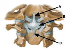 <p>What is the A arrow indicating?</p>