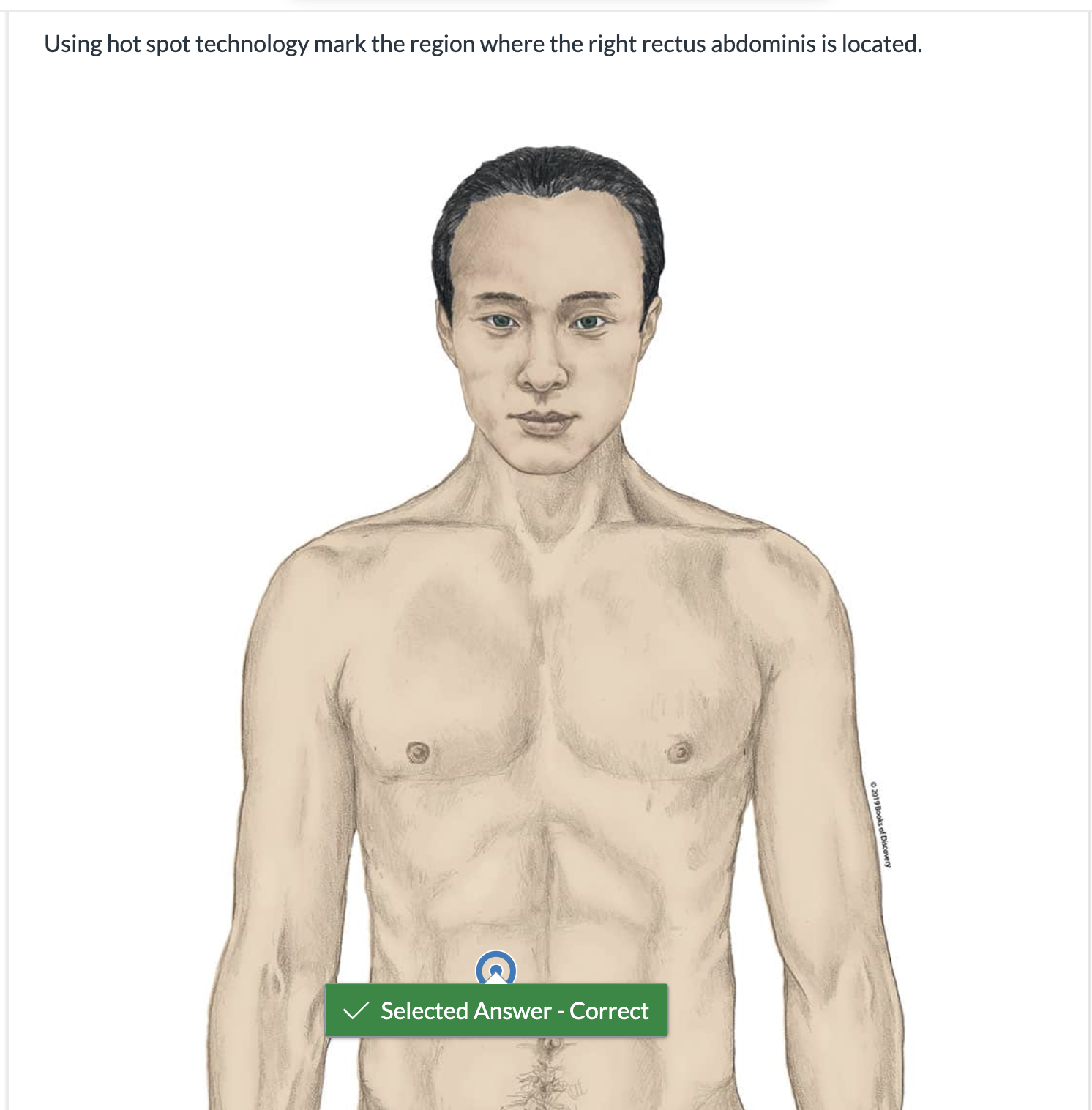 <p><span>Using hot spot technology mark the region where the right rectus abdominis is located.</span></p>