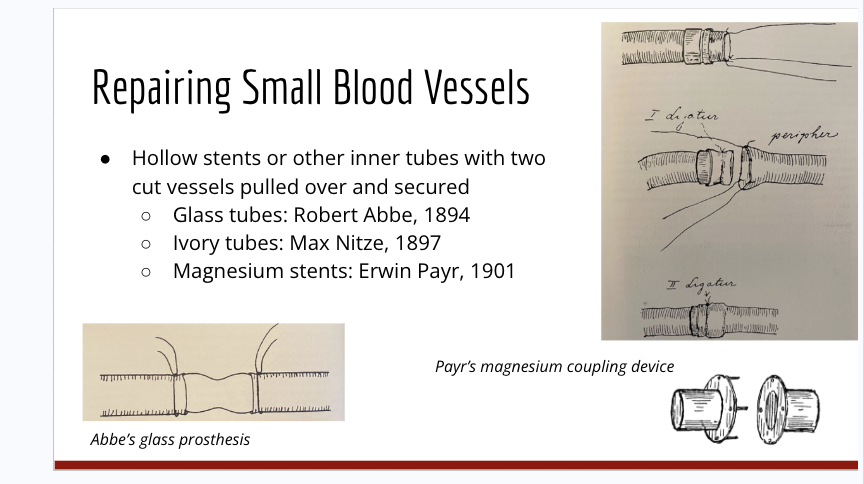 <ul><li><p>Hollow stents or other inner tubes with 2 cut vessels pulled over and secured</p><ul><li><p>used glass tubes</p></li><li><p>ivory tubes</p></li><li><p>and magnesium stents (couling device</p></li></ul></li></ul><p></p>