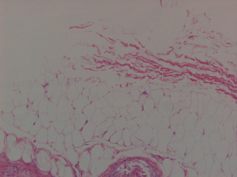 <p>What kind of tissue is this</p>