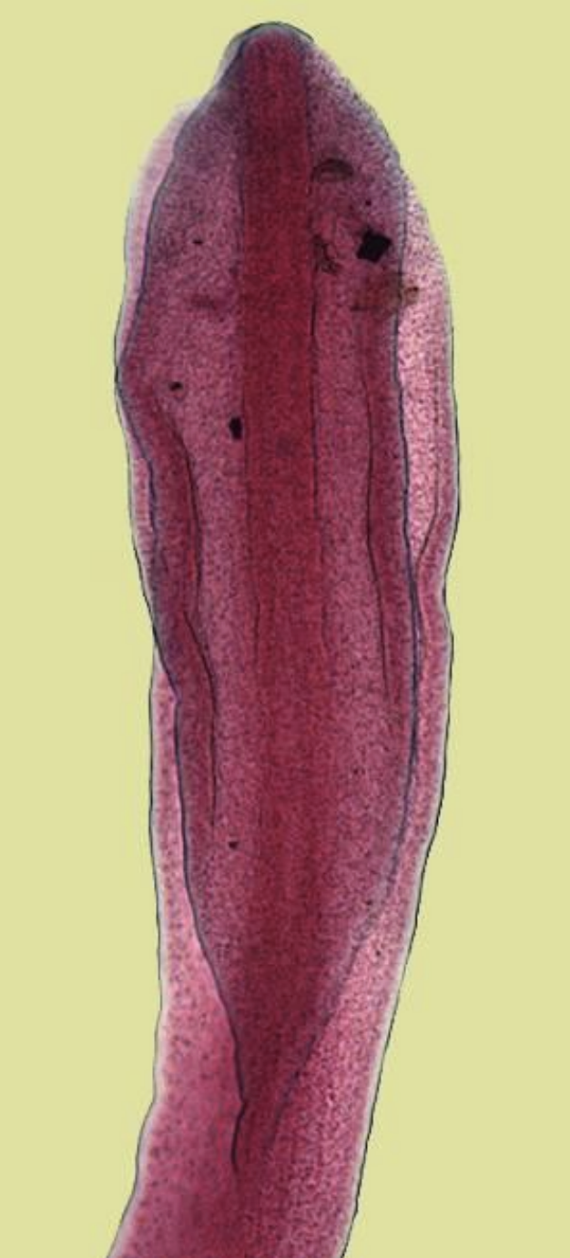 <p>name the shape of its scolex?</p>