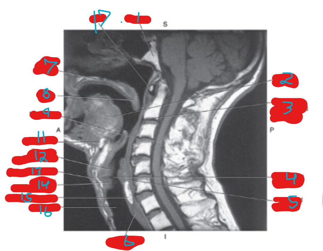 <p>what is 2</p>