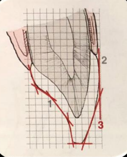 <p>-the AG can be visualized on the existing teeth or designed on restorations</p>