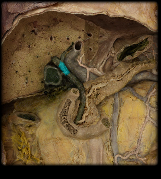 <p>receives smaller ducts from the lobes of the liver and is joined by a duct from the gallbladder</p>