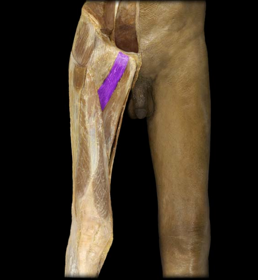 <p>What muscle is this?</p>