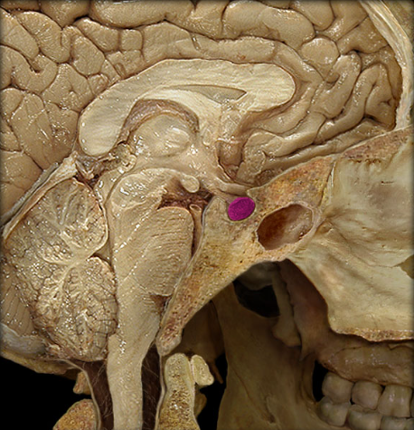 term image