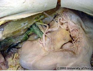 <p>what artery is being indicated to in the image?</p>