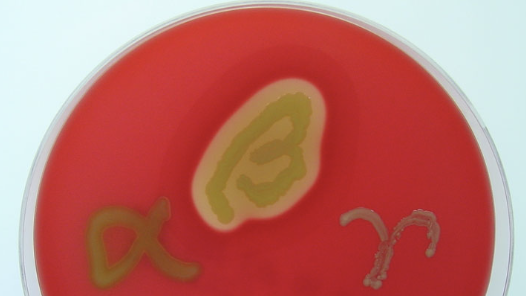 <p>beta-hemolysis (lysis of RBCs)</p>