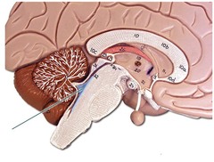 <p>the ventricle located between the cerebellum and the dorsal pons, in the center of the metencephalon</p>