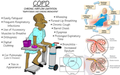 <p>chronic obstructive pulmonary disease</p>