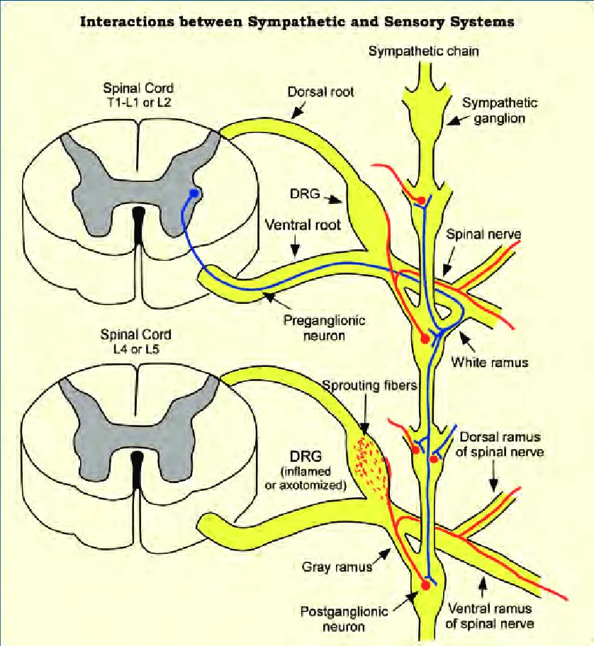 <p>Sympathetic preganglionic in lateral horn</p><p> → form shoal-like structure</p><p>located in intermediolateral gray matter (Rexed lamina VII).</p>