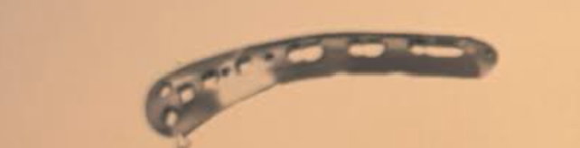 <p>What plate is this </p>