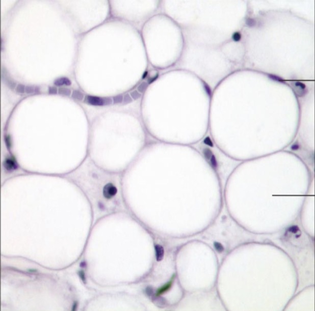 <p>what is the name of this tissue?</p>