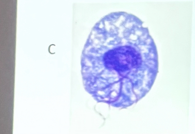 <p>What is this organism?</p>