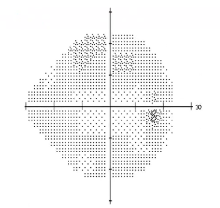 <p>interpreting VF plot: grayscale </p>