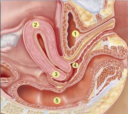 <p>What structure is #3?</p><p>a. Bladder</p><p>b. Cervix</p><p>c. Uterus</p><p>d. Rectum</p>