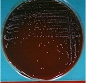 <p>What type of hemolysis means <strong>no destruction</strong> of RBC’s (red blood cells)? (example: <em>Staphylococcus epidermidis</em>)</p>