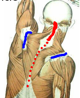 <p>What is the blue-lighted region, is it an origin/insertion, and for what muscle?</p>