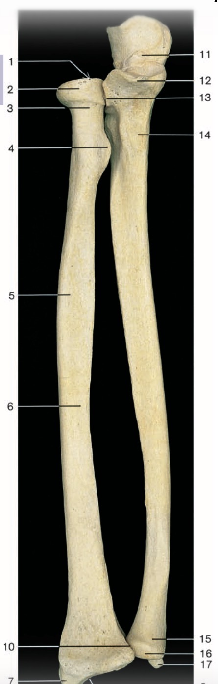 <p>Pinche 13</p>