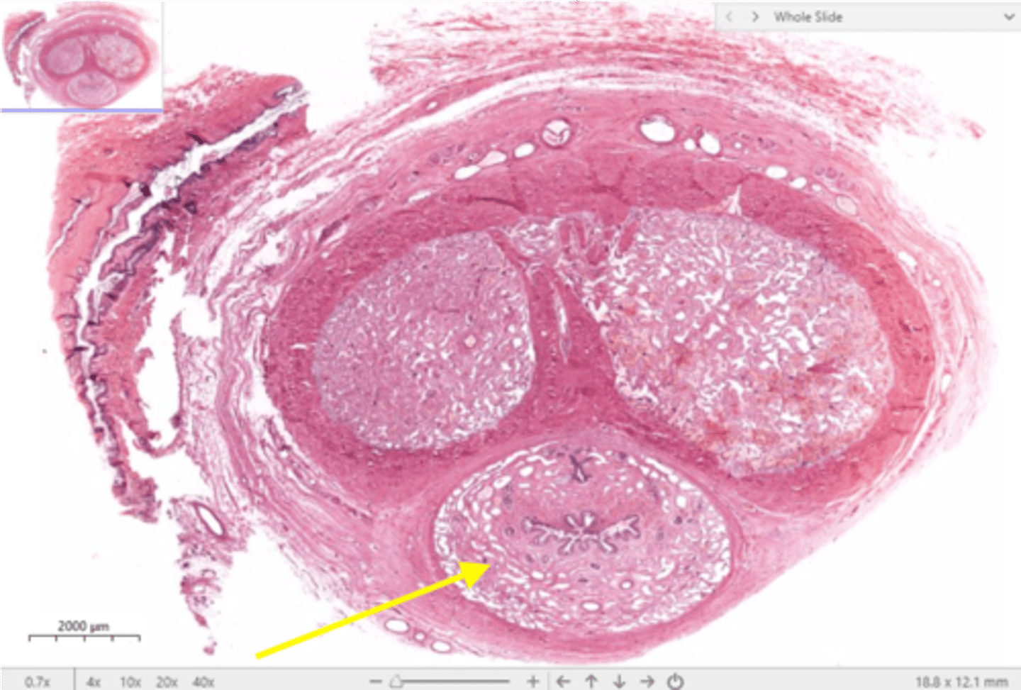 <p>surrounds urethra and expands to form glans and bulb</p>