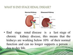 <p>end stage renal disease</p>