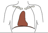 <p>what is the body habitus</p>