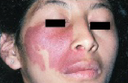 <p>다음과 같은 증상을 보일 떄, 가장 적절한 진단명은?</p>