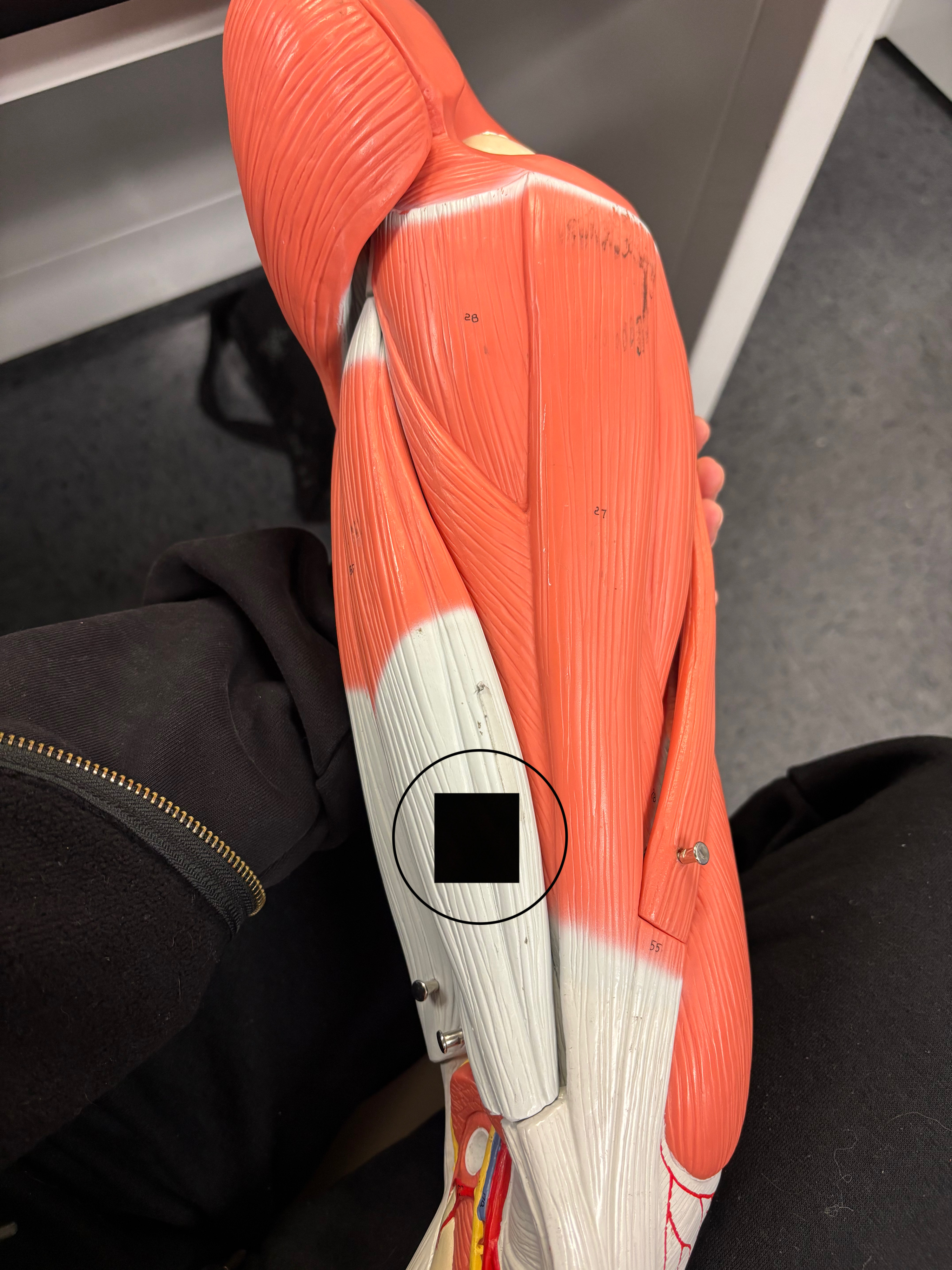 <p>What muscle is this and what is its action?</p>