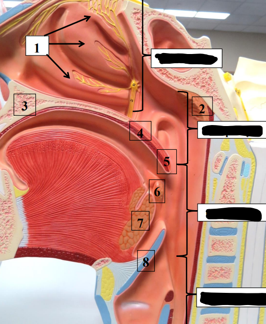 <p>Label this image (black boxes only).</p>