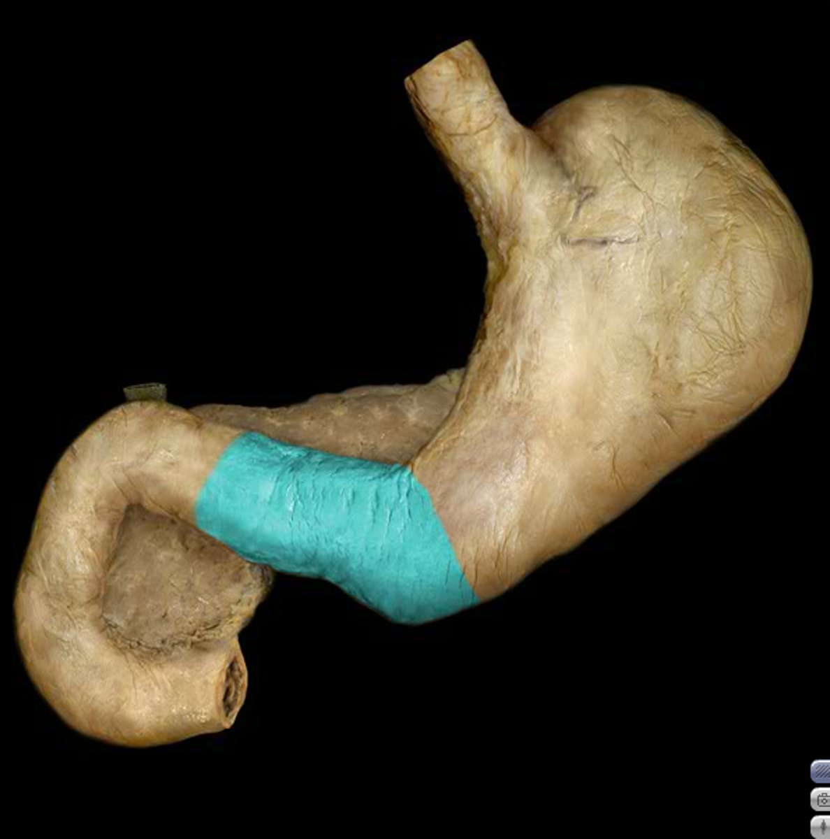 <p>pyloric antrum - vestibule, packs large volume of food into a smaller volume</p><p>pyloric canal - stomach-duodenum junction</p><p>pyloric sphincter - controls opening/closing of orifice to turn digestion on/off</p><p>pyloric orifice - point of passage of chyme from stomach to duodenum</p>