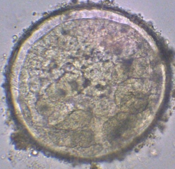 <p>What helminth/fluke/parasitic worm is this?</p>