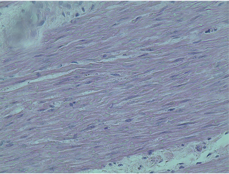 <p>what is this tissue</p>