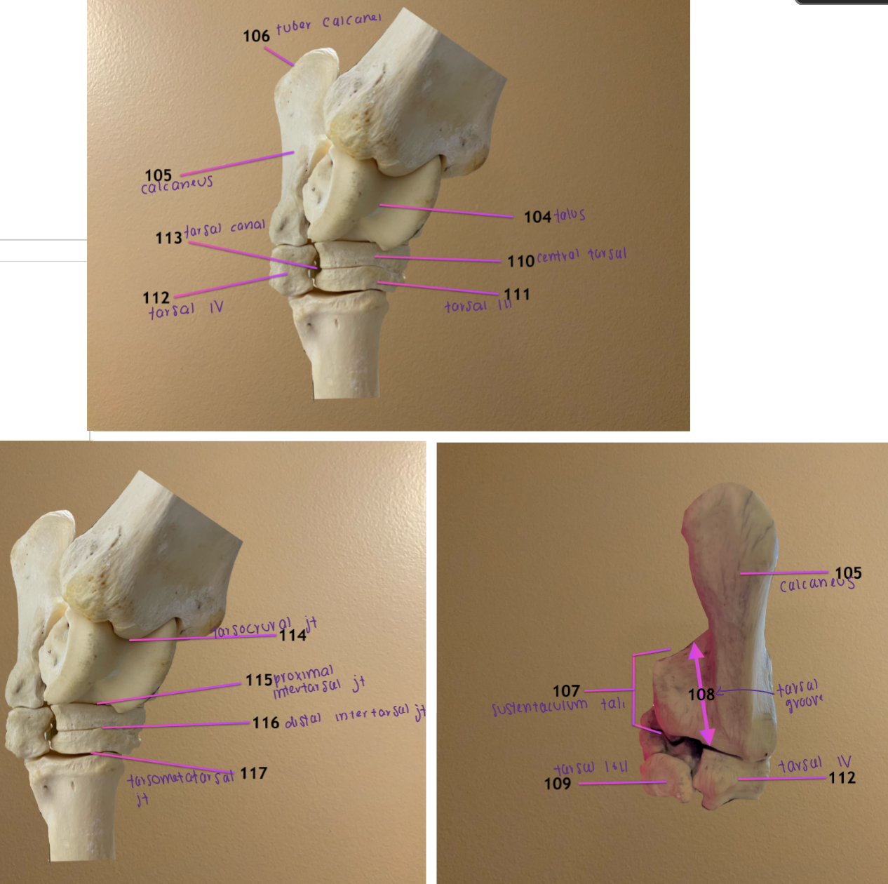 <ol start="108"><li><p>tarsal groove: curved caudal surface of sustentaculum tali</p></li><li><p>fused tarsal bone I &amp; II</p></li><li><p>central tarsal bone</p></li><li><p>tarsal bone III</p></li></ol><p></p>