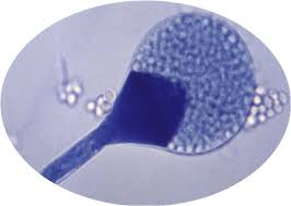 <p>This mode of asexual production is a sac-like structure containing spores</p><ul><li><p>Rhizopus</p></li><li><p>Aspergillus</p></li></ul><p></p>