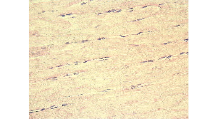 <p>Identify the connective tissue below.</p>