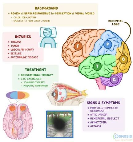 <p>Occipital Lobes</p>